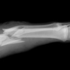 Broken Bones and A Typical (Vampire) Family