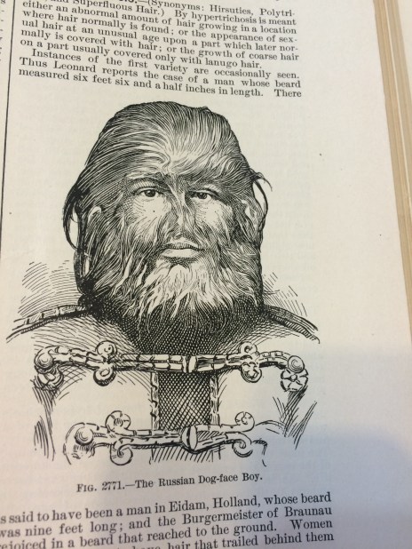 jojo the dogfaced boy